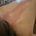 施術後の写真(ハンドセラピス)